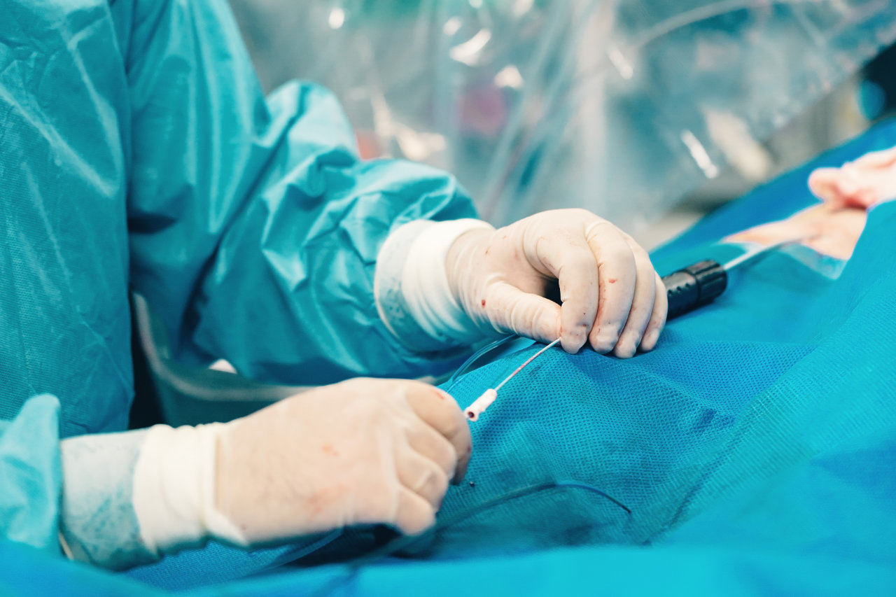 Angiogram