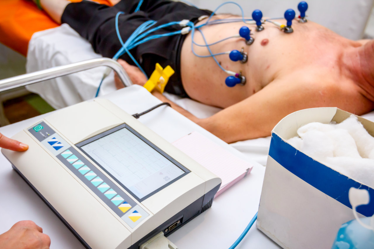 Echocardiogram